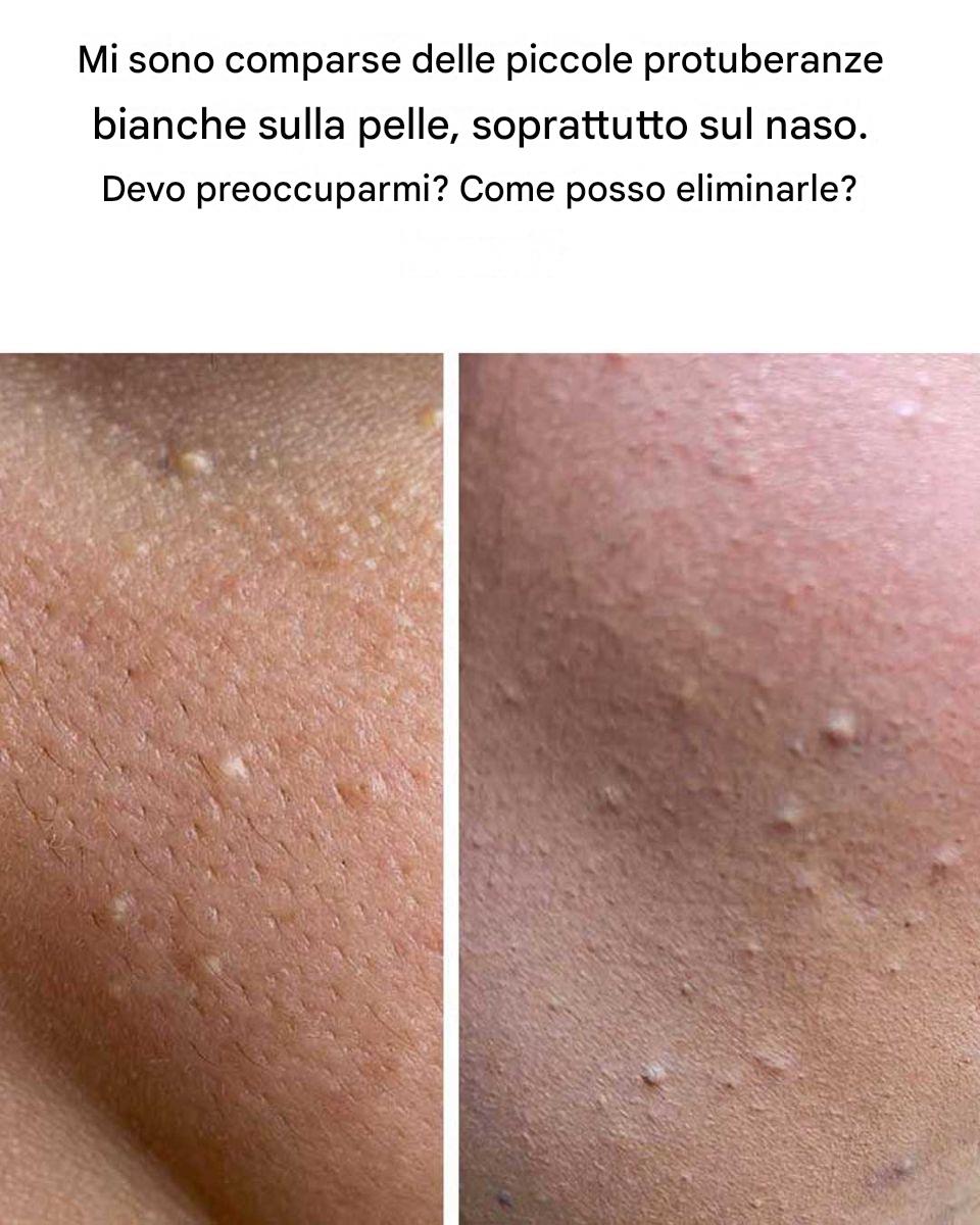 I really am annoyed by these!