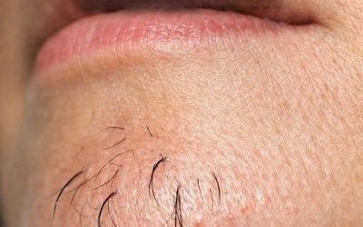 I peli del mento di una donna sono segno di… Vedi di più