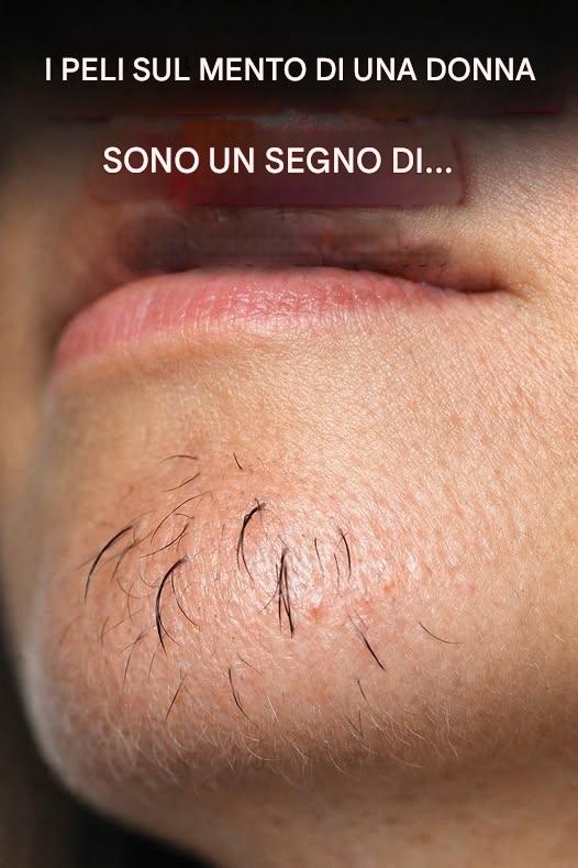 I peli del mento di una donna sono segno di… Vedi di più