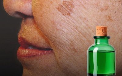 L’olio miracoloso che rimuove le macchie dell’età!