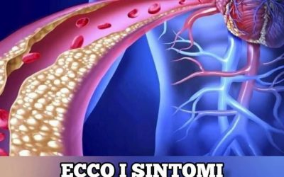 Ecco i sintomi dell’ ipercolesterolemia che state ignorando. Meglio fare attenzione (1 / 2)
