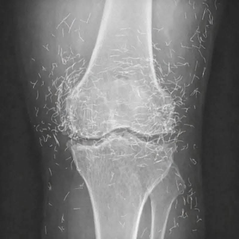 Va in ospedale per un dolore al ginocchio: la radiografia lascia tutti a bocca aperta (1 / 2)