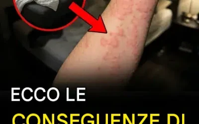 Brufoli pruriginosi al risveglio: cosa succede se il materasso nasconde le cimici dei letti?