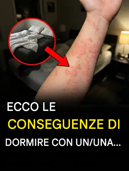 Brufoli pruriginosi al risveglio: cosa succede se il materasso nasconde le cimici dei letti?