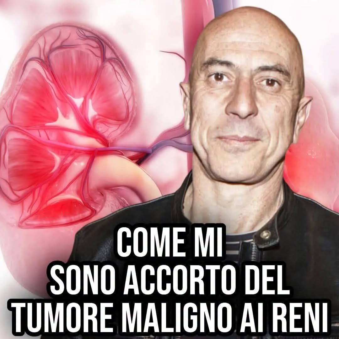 Ciufoli e la neoplasia maligna ai reni: “L’ho scoperta grazie a questo sintomo”