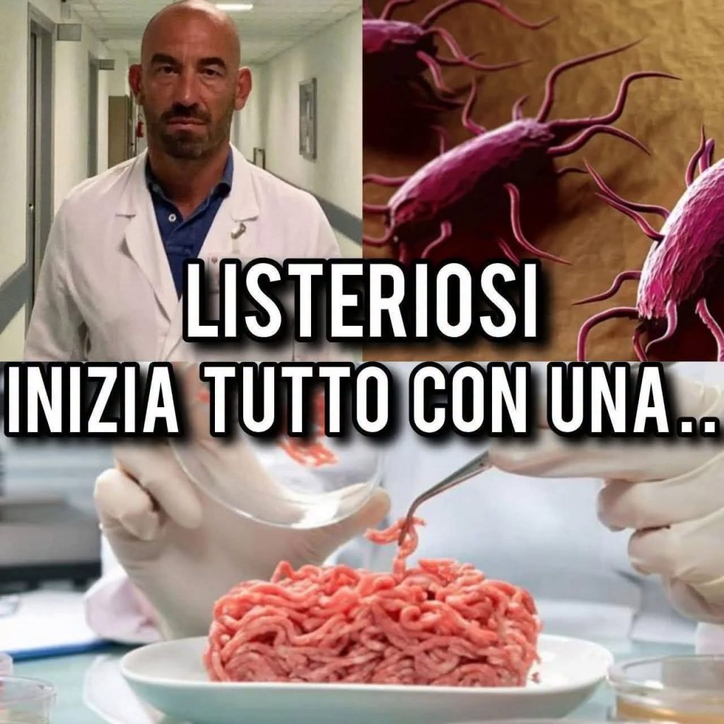 Listeriosi, ecco i sintomi a cui prestare attenzione