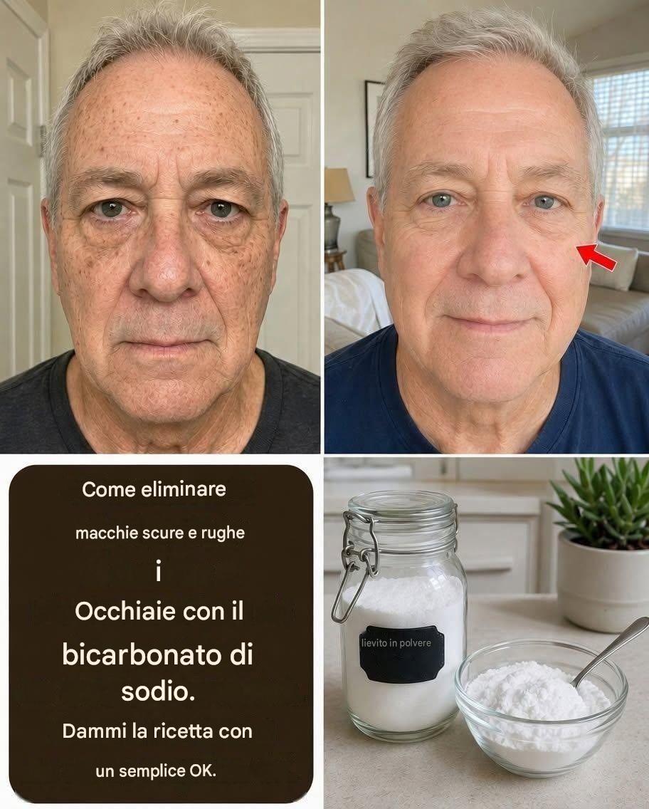 Bicarbonato di sodio per il viso: benefici, rischi e come usarlo in sicurezza (più 4 ricette delicate)